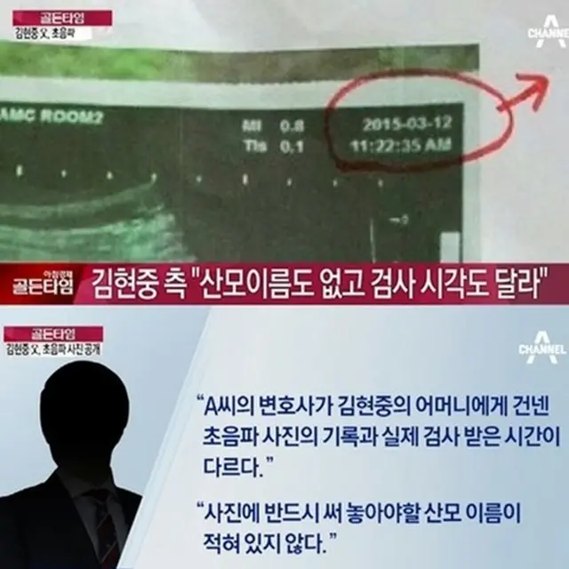 韓国俳優兼歌手のキム・ヒョンジュン側が元恋人の超音波写真を公開した。（提供:news1）
