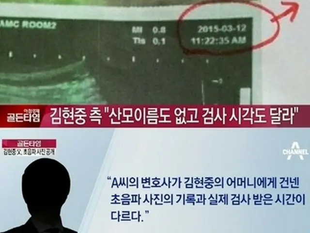 韓国俳優兼歌手のキム・ヒョンジュン側が元恋人の超音波写真を公開した。（提供:news1）
