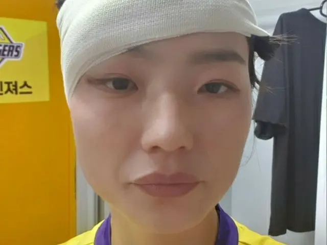女芸人アン・ヨンミ、番組で目を負傷…写真公開に衝撃「心配してくれてありがとう」（画像提供:wowkorea）