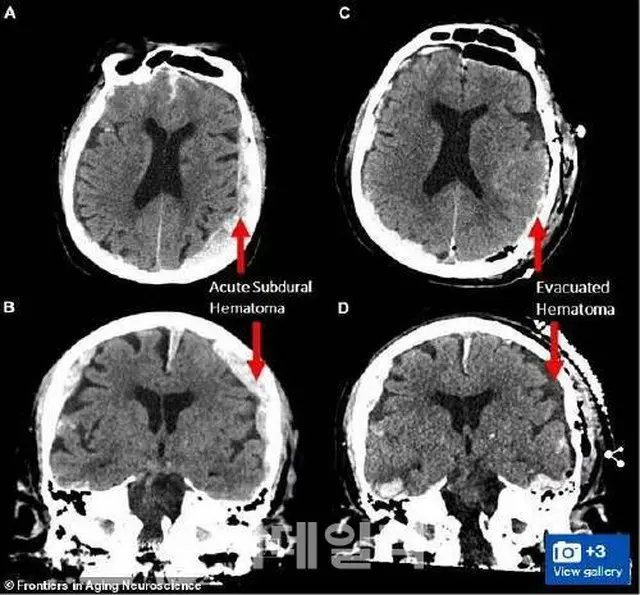 走馬灯は現実だった、米大学の研究で明らかに＝韓国報道（画像提供:wowkorea）