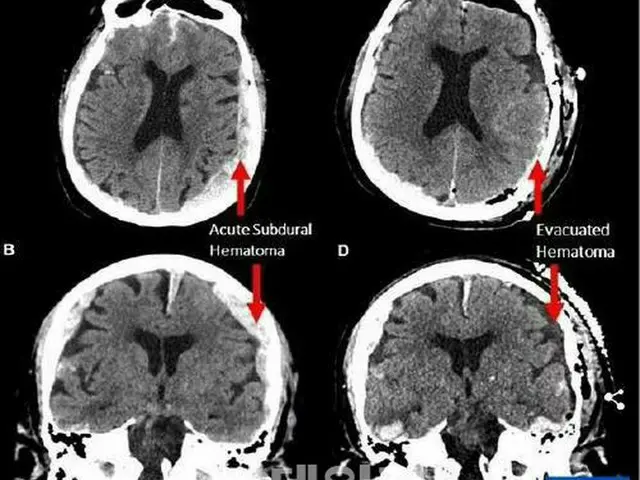 走馬灯は現実だった、米大学の研究で明らかに＝韓国報道（画像提供:wowkorea）